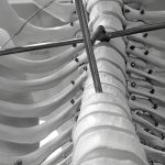 Intricate black and white photo of a human rib cage model with metal rods and wires